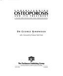 Understanding osteoporosis and its treatment