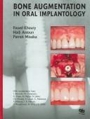 Bone augmenation [i. e. augmentation] in oral implantology
