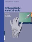 Orthopädische Handchirurgie