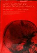 Acute Hemiplegias & Hemisyndromes in Childhood