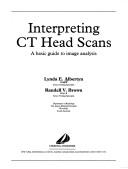 Interpreting CT Head Scans
