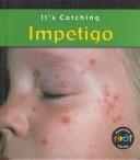 Impetigo (It's Catching)