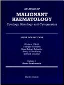 An Atlas of Malignant Haematology