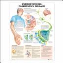 Understanding Parkinson's Disease Anatomical Chart
