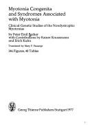 Myotonia congenita and syndromes associated with myotonia