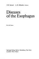Diseases of the esophagus