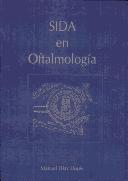Sida En Oftamologia
