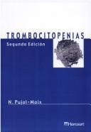 Trombocitopenias
