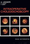 Intraoperative Choledochoscopy