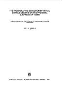 The radiographic detection of initial carious lesions on the proximal surfaces of teeth