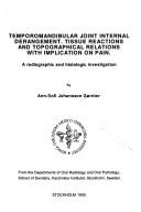Temporomandibular joint internal derangement