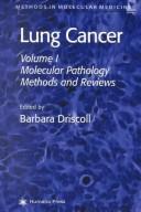 Lung cancer
