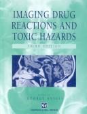 Imaging drug reactions and toxic hazards