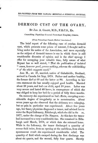 Dermoid cyst of the ovary