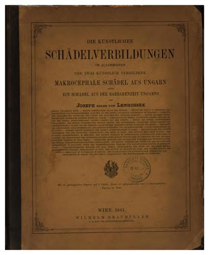 Die künstlichen Schädelverbildungen im Allgemeinen und zwei künstlich verbildete Makrocephale ...