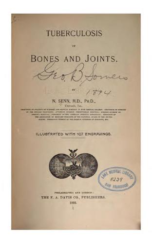 Tuberculosis of Bones and Joints