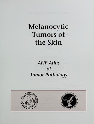 Melanocytic tumors of the skin