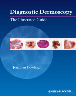 Diagnostic Dermoscopy The Illustrated Guide