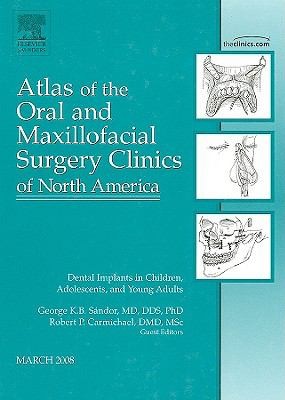 Implants In Children And Adolescents