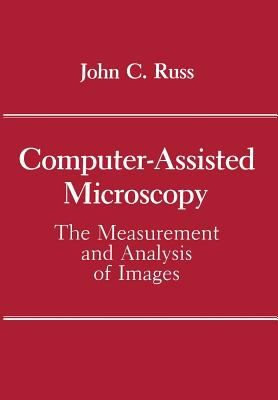 Computerassisted Microscopy The Measurement And Analysis Of Images
