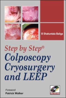 Step By Step Colposcopy Cryosurgery And Leep
