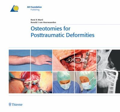 Osteotomies for Posttraumatic Deformities