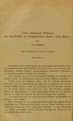 Ueber abnormen Tiefstand des Bauchfelles im Douglas'schen Raume beim Manne