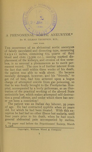 A phenomenal aortic aneurysm