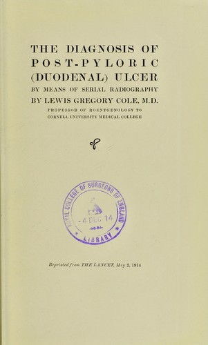 The diagnosis of post-pyloric (duodenal) ulcer by means of serial radiography