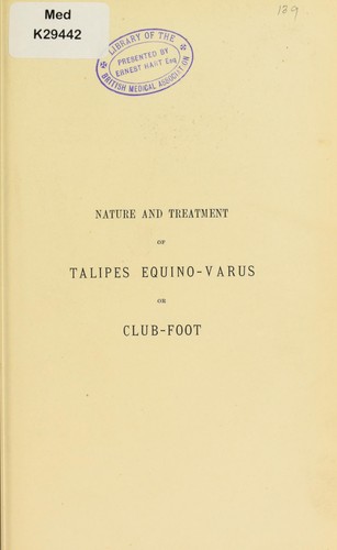On the nature and treatment of talipes equino-varus or club-foot