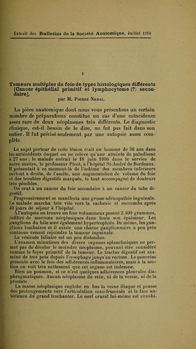 Tumeurs multiples du foie de types histologiques différents (cancer épithélial primitif et lymphocytome (?) secondaire ...