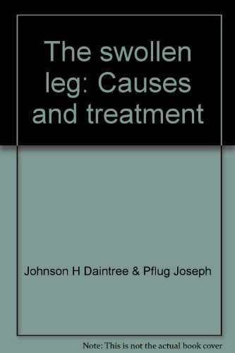 The swollen leg