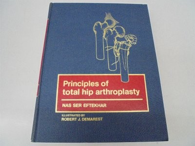 Principles of total hip arthroplasty