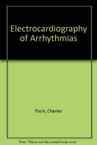 Electrocardiography of arrhythmias