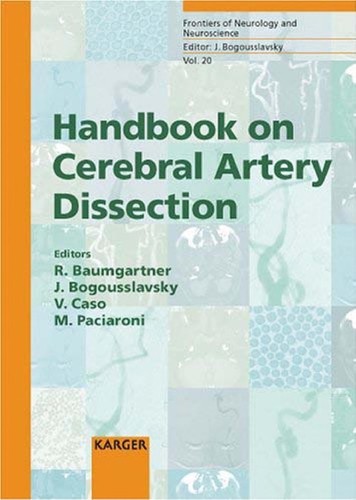Handbook on cerebral artery dissection