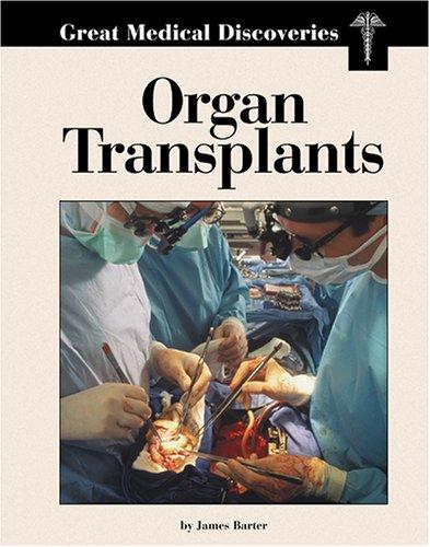 Organ transplants