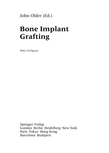 Bone Implant Grafting