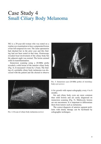 Clinical Ophthalmic Echography