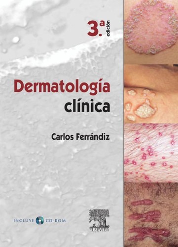Dermatología clínica