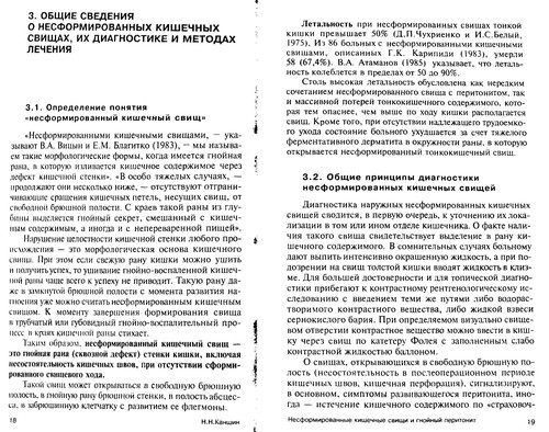 Nesformirovannye kishechnye svishchi i gnoĭnyĭ peritonit