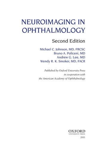 Neuroimaging in ophthalmology