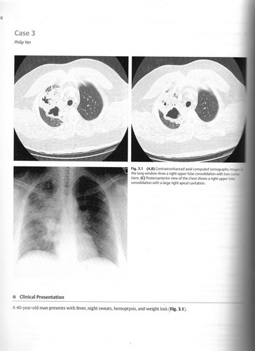 Top 3 differentials in radiology