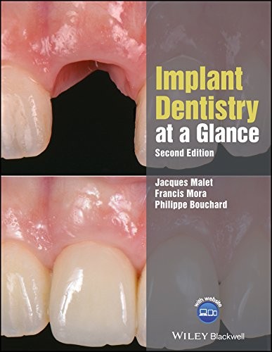 Implant dentistry at-a-glance