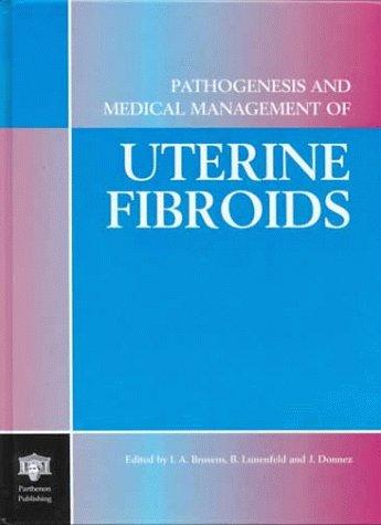 Pathogenesis and medical management of uterine fibroids