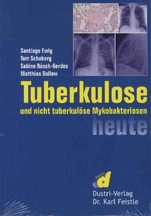 Tuberkulose und nicht tuberkulöse Mykobakteriosen heute