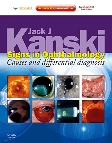 Signs in Ophthalmology : Causes and Differential Diagnosis