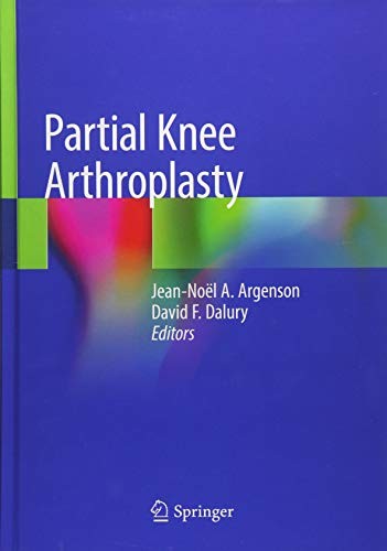 Partial Knee Arthroplasty