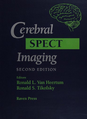 Cerebral SPECT imaging