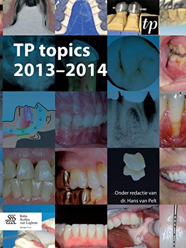 TP topics 2013-2014