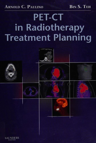 PET-CT in radiotherapy treatment planning